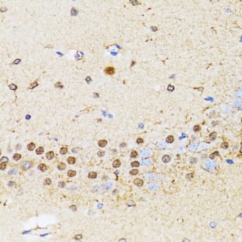 CHAF1B / CAF1 Antibody