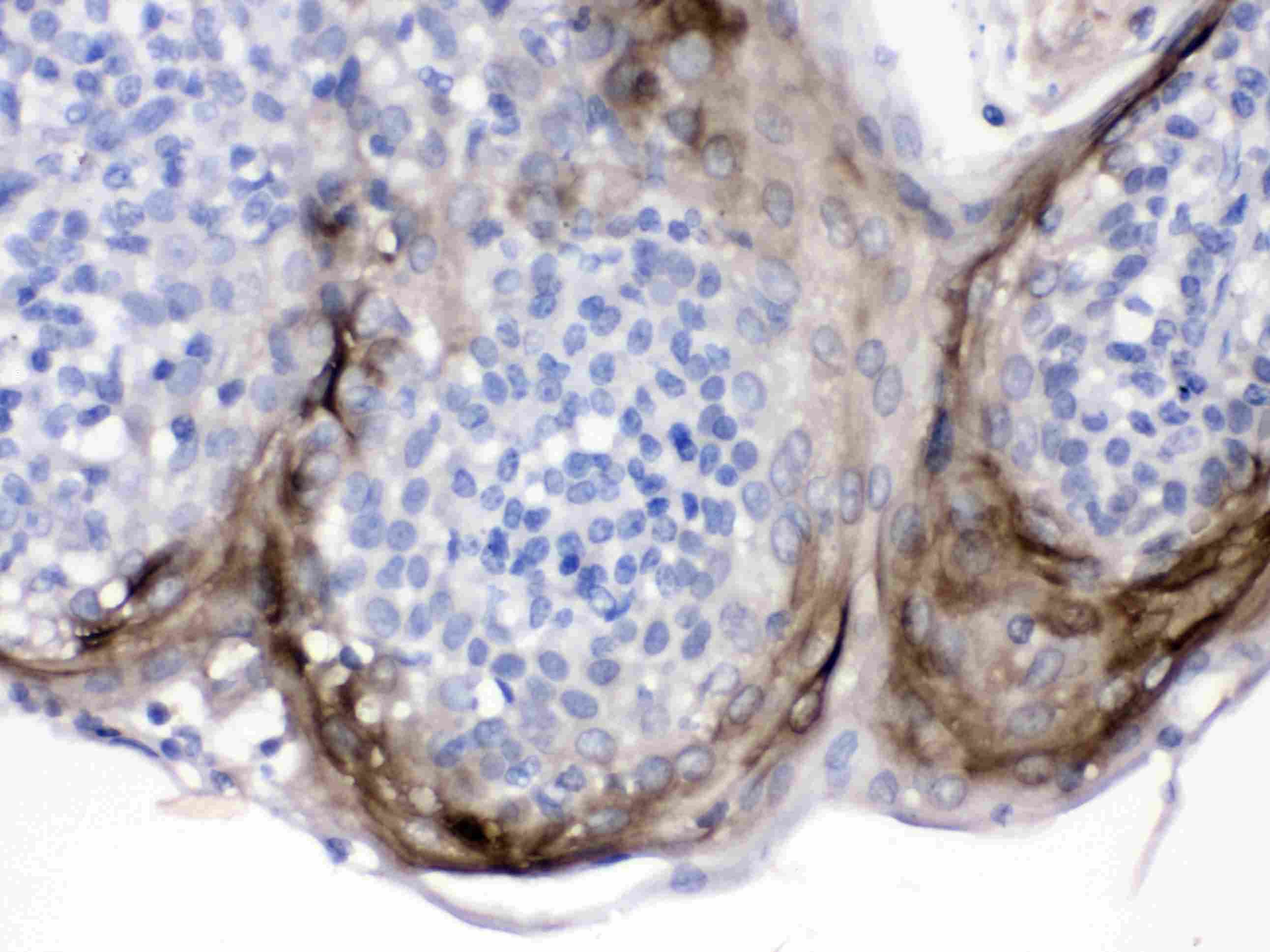 PI3 / Elafin Antibody