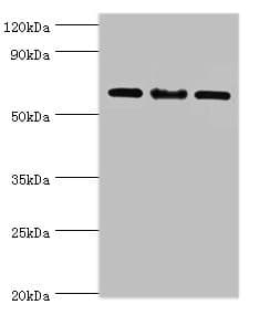 IL22RA1 / IL22R Antibody (aa16-230)