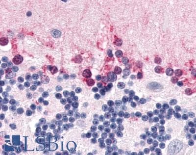 IHC-plus™ Polyclonal Rabbit anti-Human NR1D2 Antibody (Ligand-binding Domain, IHC)