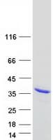 Human AK2 / Adenylate Kinase 2 Protein (Recombinant Myc-DDK (Flag))
