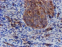 EPN2 Antibody (clone OTI1F1)