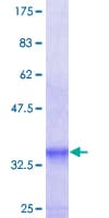 Human T1R1 / TAS1R1 Protein (Recombinant GST, N-terminus)