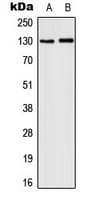 CSF2RB / CD131 Antibody (phospho-Tyr593)