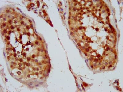Polyclonal Rabbit anti-Human KIFAP3 / KAP3 Antibody (IF)