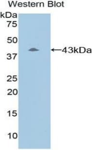 Complement C8b Antibody (aa161-503, HRP)