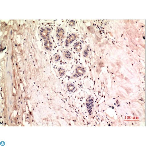 Monoclonal Mouse anti-Human TUBG1 / Tubulin Gamma 1 Antibody (IHC)