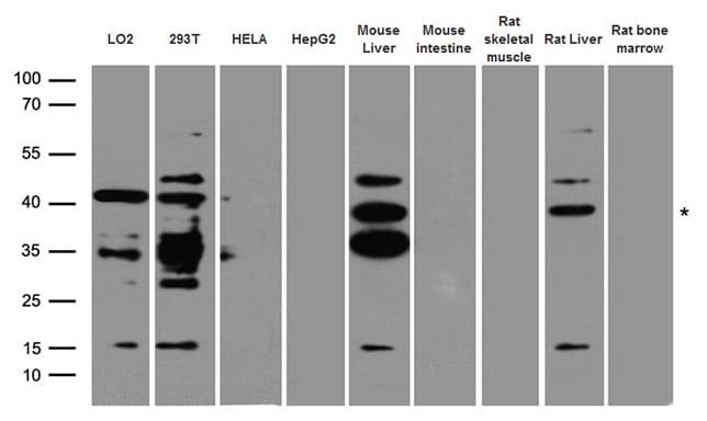 AGXT / SPT Antibody