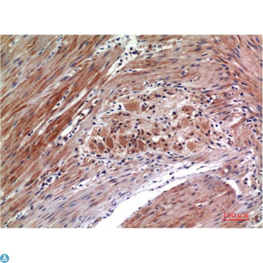 Monoclonal Mouse anti-Human MAPK3 / ERK1 Antibody (IHC)