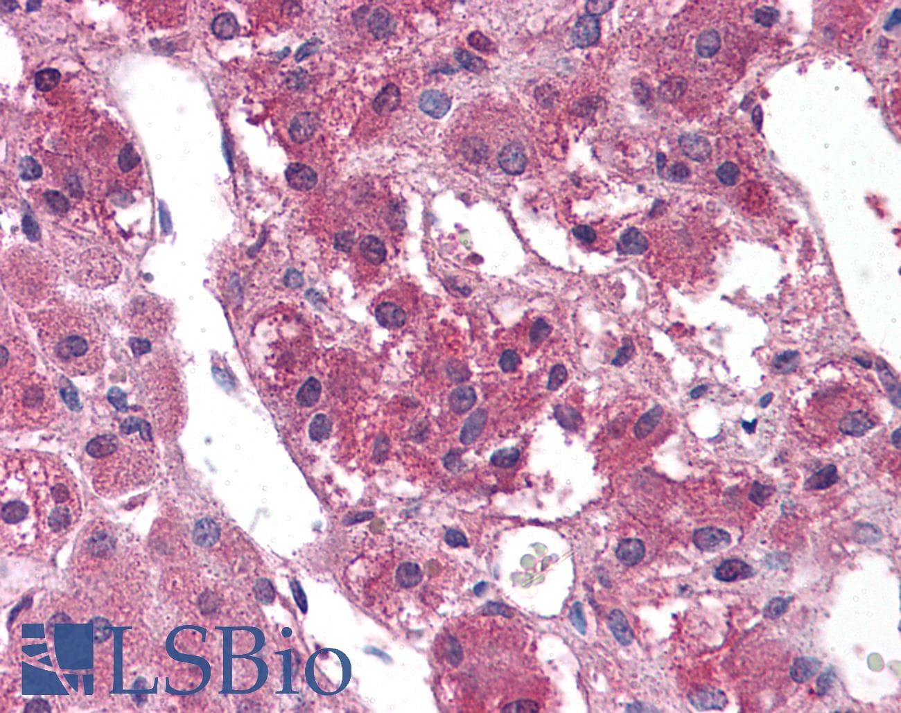 IHC-plus™ TM9SF1 Antibody (Internal)
