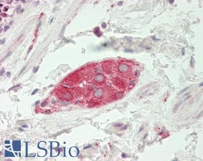 BCKDK Antibody (aa111-160)