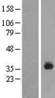 SPIN4 Protein (Over-Expression Lysate Myc-DDK (Flag))