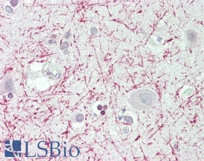 IHC-plus™ CDK5 Antibody (aa11-60)