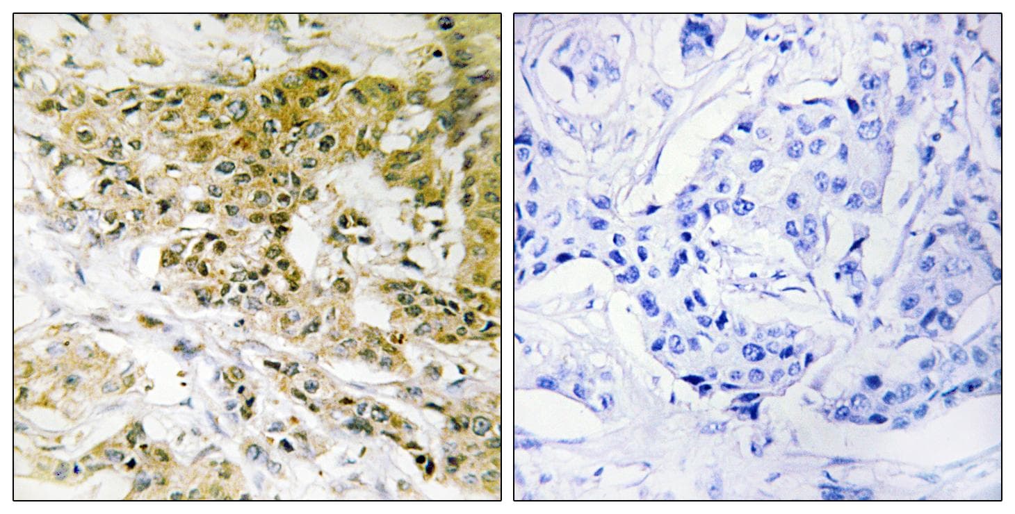 TOP2A / Topoisomerase II Alpha Antibody (p1106)
