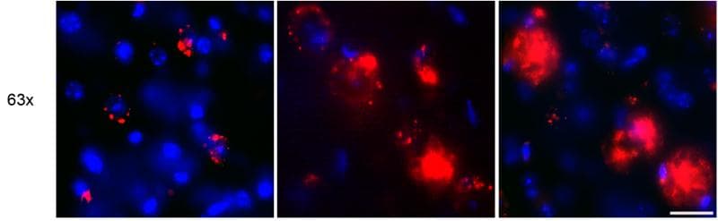 APP / Beta Amyloid Precursor Antibody (clone MOAB-2)