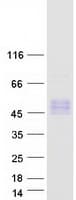 Human TPBGL Protein (Recombinant Myc-DDK (Flag))