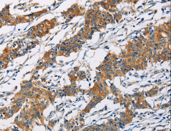 Polyclonal Rabbit anti-Human PIP4K2A / PIPK Antibody (IHC, WB)