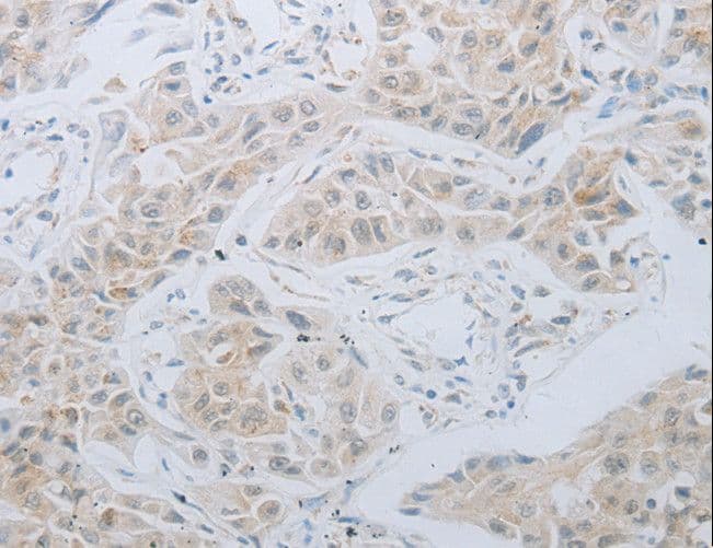 Polyclonal Rabbit anti-Human LOX / Lysyl Oxidase Antibody (IHC, WB)
