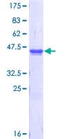 Human USP9X / FAM Protein (Recombinant GST, N-terminus)
