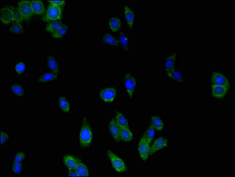MLC1 / MLC Antibody