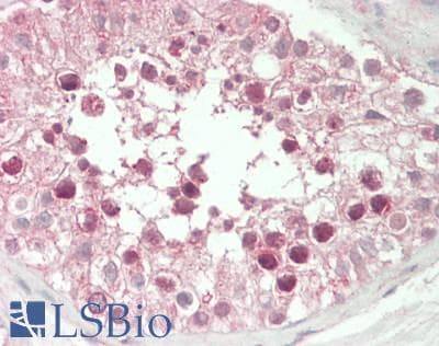 IHC-plus™ Polyclonal Rabbit anti-Human TMF1 / TMF-1 Antibody (aa600-650, IHC, WB)
