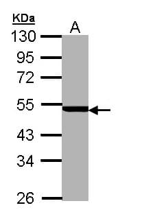 PSMC3 Antibody (aa51-361)