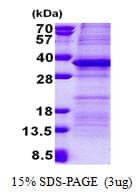 Human PSG / PSG5 Protein (Recombinant His)