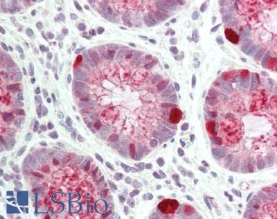 IHC-plus™ Polyclonal Rabbit anti-Human SPINK1 Antibody (Internal, IHC, IF)