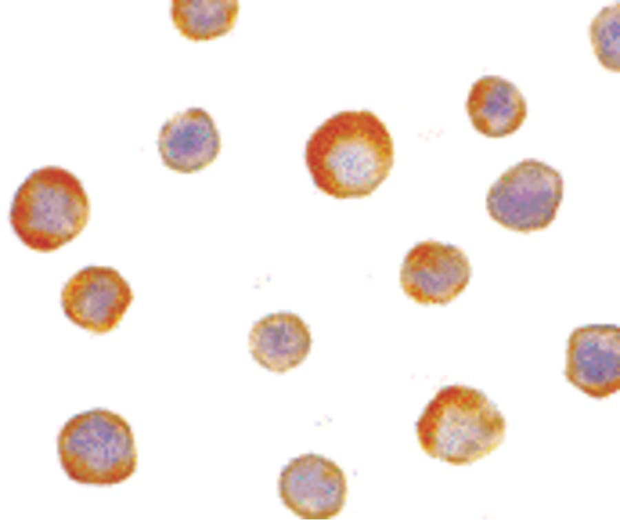 IHC-plus™ IKBKG / NEMO / IKK Gamma Antibody