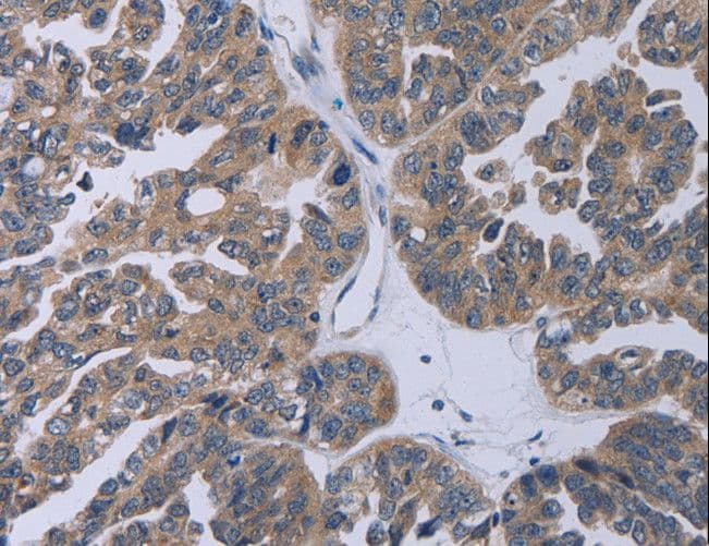 TP53AIP1 / p53 AIP1 Antibody