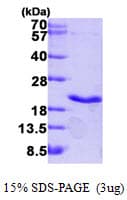Human LTA / TNF Beta Protein (Recombinant His)