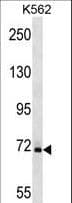 SAMHD1 Antibody (aa204-230)