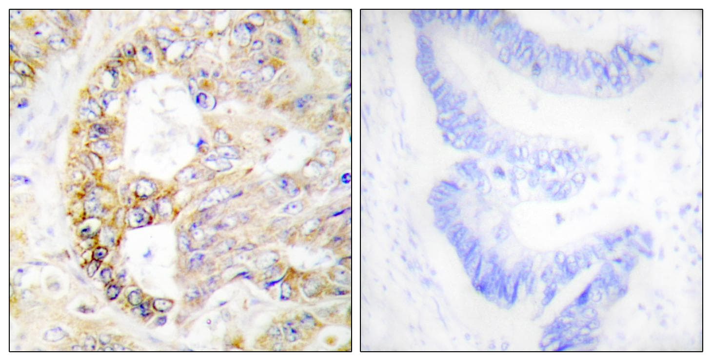 Polyclonal Rabbit anti-Human COXIV / COX4 Antibody (IHC, WB)