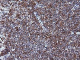 CD1C Antibody (clone OTI1H9)