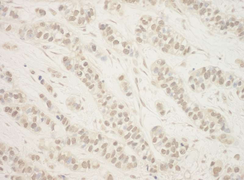 IHC-plus™ Polyclonal Rabbit anti-Human FLCN / Folliculin Antibody (aa1-50, IHC, WB)