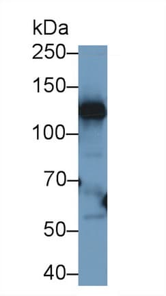 CP / Ceruloplasmin Antibody (aa789-1065)