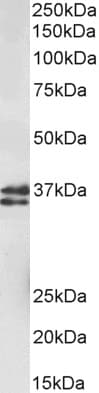 IHC-plus™ Polyclonal Goat anti-Human MSI2 Antibody (N Terminus, IHC, WB)
