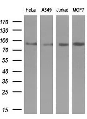AR / Androgen Receptor Antibody (aa420-659, clone OTI2H2, Carrier-free)