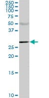 CA1 / Carbonic Anhydrase I Antibody (clone M2)