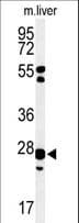 Polyclonal Rabbit anti-Human GSTK1 Antibody (aa93-120, IHC, WB)