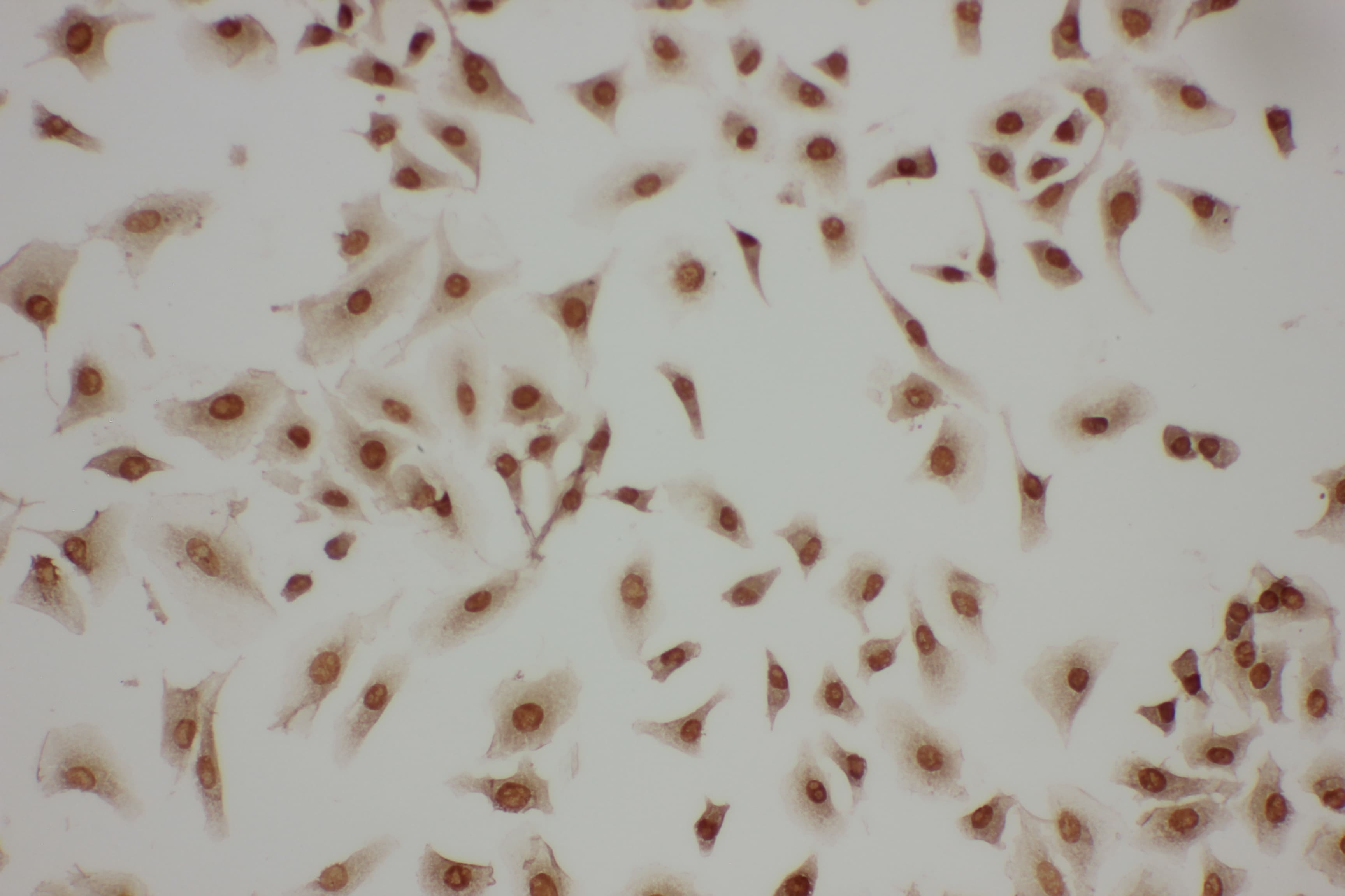LASP1 Antibody (aa16-30)