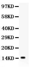 IL15 Antibody (aa49-162)