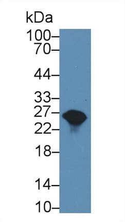 GSTA1 Antibody (aa2-223, FITC)