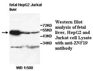 ZNF19 Antibody (aa6-235)