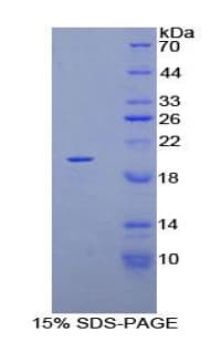Human KRT81 / Keratin 81 / KRTHB1 Protein (Recombinant His)