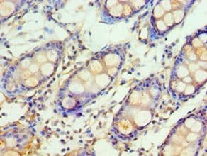 GSTM4-4 / GSTM4 Antibody (aa1-218)