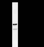 DDX5 Antibody (clone 2257C3a)