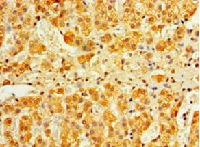 IFNA4 / Interferon Alpha 4 Antibody (aa24-189, Biotin)