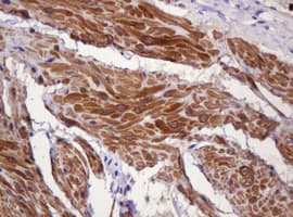 PADI4 / PAD4 Antibody (clone OTI5C10)