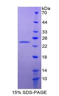Mouse ANGPTL8 / Betatrophin Protein (Recombinant His-T7)
